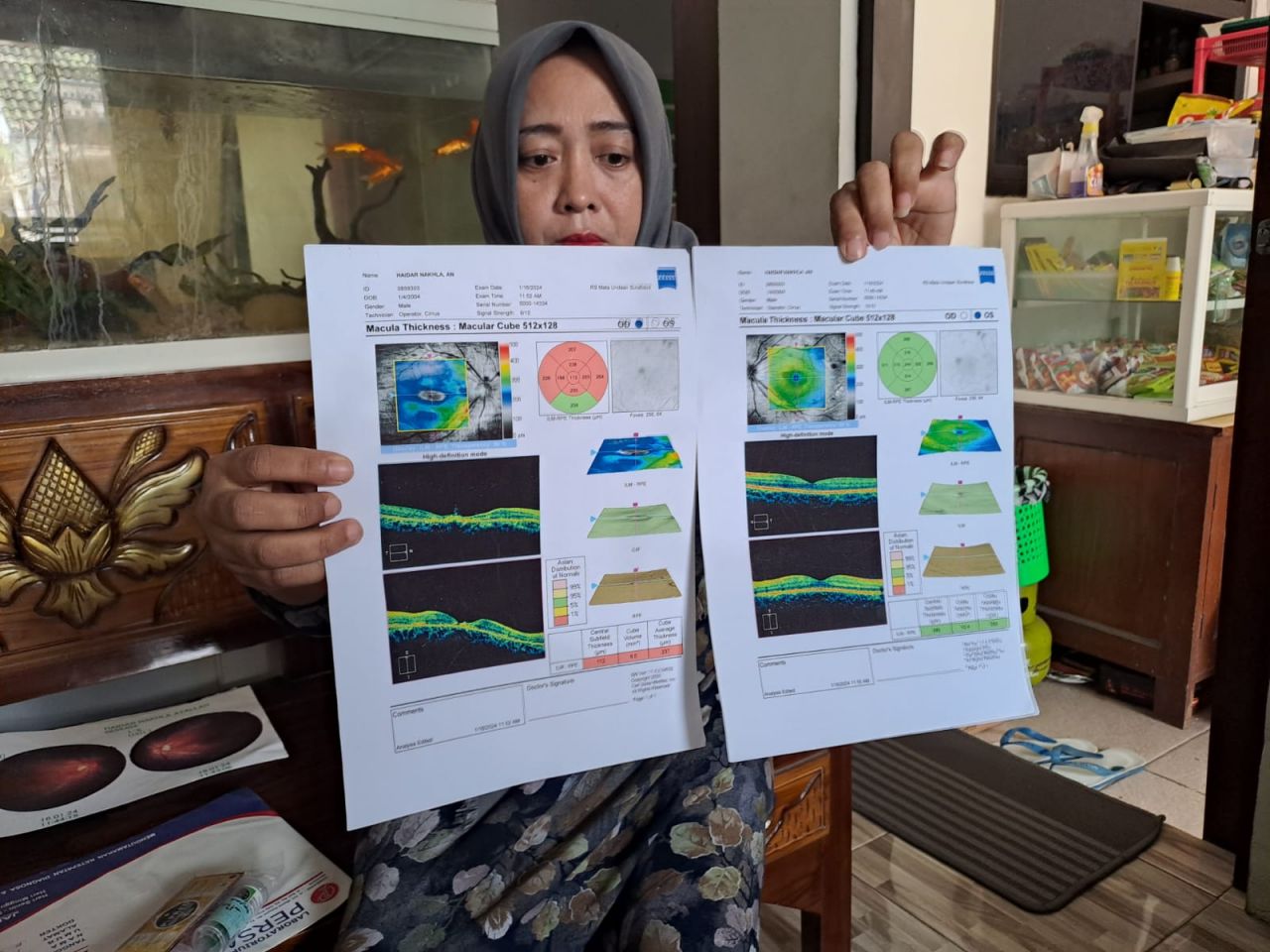 Pelajar SD Nyaris Buta Terkena Lemparan Kayu di Jombang, Orang Tua: Ganti Rugi Tak Sepadan!