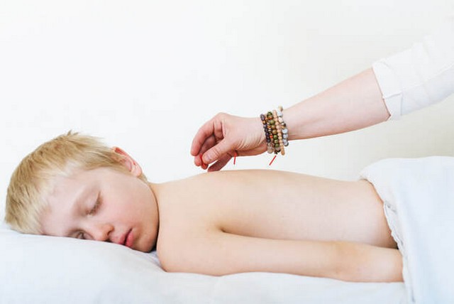 Dokter: Akupuntur Bisa Jadi Terapi Pasien Ginjal Kronik Anak