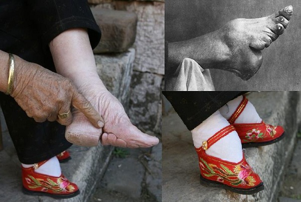 Budaya Unik Lotus Feet di China yang Dianggap Cantik   