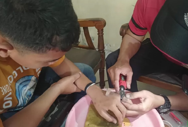Jari Bengkak Gara-Gara Cincin, Pemuda di Mojokerto Lapor ke Petugas Damkar